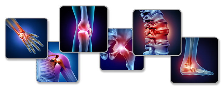 Five digital images of inflamation at various sites in the body