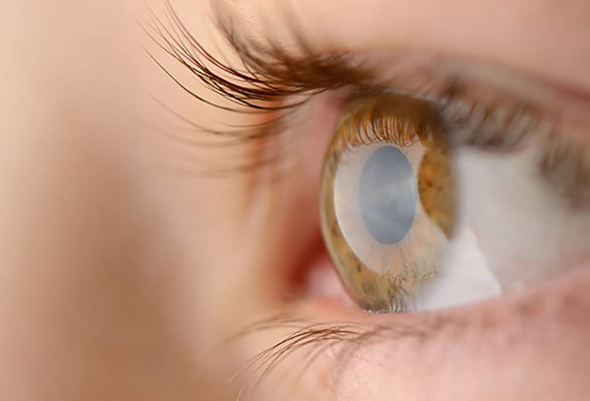 Human eye seen sideways on