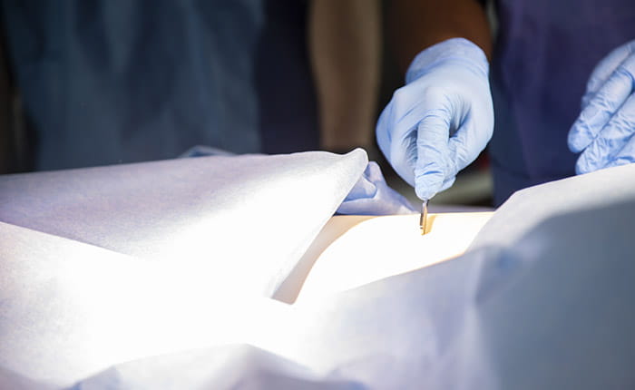 The hand of an ODP student practicing making an incision in a darkened skills lab