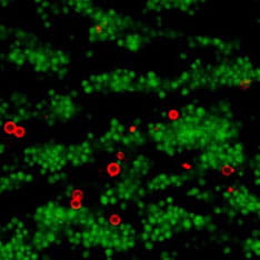 Image of whole human blood flowing over a thromogenic substrate, with platelets in the blood stained fluorescent green.